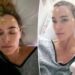 Teddi Mellencamp marks 1st anniversary of her brain surgery