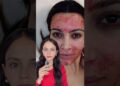 Celebrity beauty secret 🤫 #shorts#celebrity #transformation #makeup #microneedling #beauty
