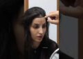 The secret of Nora’s perfect hairline😲#shorts#bollywood #norafatehi#hairtransplant #celebrity