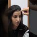 The secret of Nora’s perfect hairline😲#shorts#bollywood #norafatehi#hairtransplant #celebrity