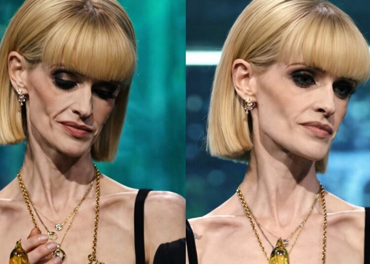 These Celebs Are ADDICTED TO OZEMPIC (Before & After Photos)