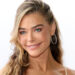 Denise Richards Drops Jaws in Before & After Facelift Photos