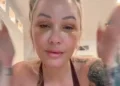 Bunnie Xo underwent the facelift after quitting filler (Instagram/@xomgitsbunnie)