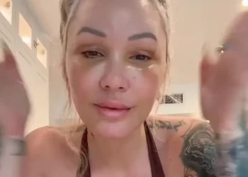 Bunnie Xo underwent the facelift after quitting filler (Instagram/@xomgitsbunnie)