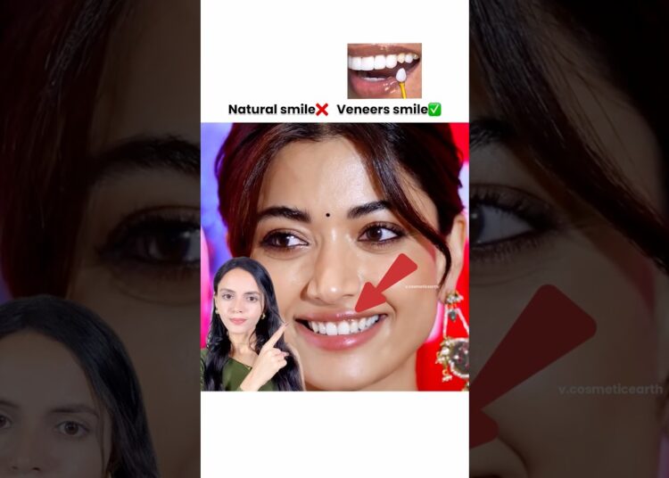 Celebrity’s fake smile with veneers😂👍🏻#shorts #celebrity#bollywood#veneers #smile #smilemakeover