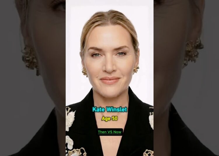 Beautiful Icons of 1980–1990s ✨ Then vs Now 🔥#celebrity #feedshorts #legend