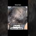 My hair regrowth supplements list that i take daily #hair #hairregrowth #celebrity #hairfall