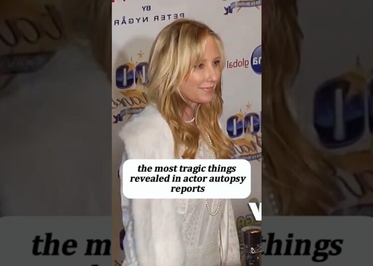 The most tragic things revealed in actor autopsy reports #celebrity #hollywood #actor #singer #music