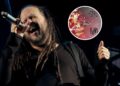 Hear Korn's Fiery New Song 'Reward the Scars'