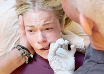 LeAnn Rimes receiving the jaw release procedureCredit: Leann Rimes/Instagram