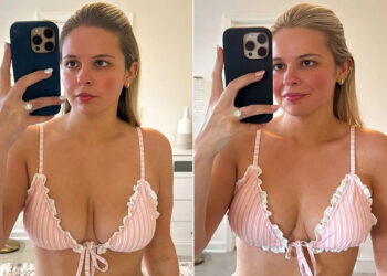 Influencer Darcy McQueeny Reveals the Results of Her Breast Lift: 'Best Decision of My Life'