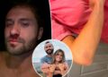 Taylor Frankie Paul and Dakota Mortensen showcase gruesome, bloody injuries from alleged domestic violence incidents