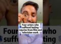 Four actors who suffered lasting injuries from film and television work #celebrity #famous #fyp #us