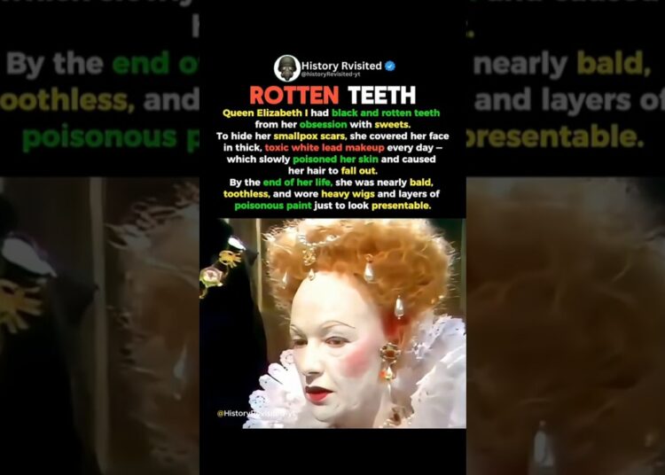 Queen Elizabeth’s Teeth Horrified People #shorts