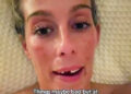 Katrina Kelly with her missing tooth.Credit: Kennedy News/@katrinakelly23
