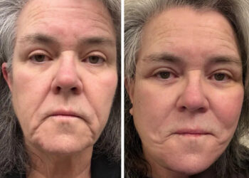 <span class="wp-caption-text">Instagram/Rosie O’Donnell</span>