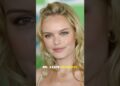 Celebrities with Birth Defects #celebrities #celebrity #movie #foryoupage #usa