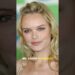 Celebrities with Birth Defects #celebrities #celebrity #movie #foryoupage #usa