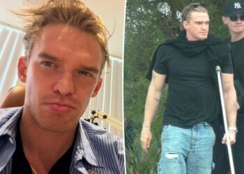 Cody Simpson unable to walk or talk after horrifying double injury: 'I'll be back stronger'