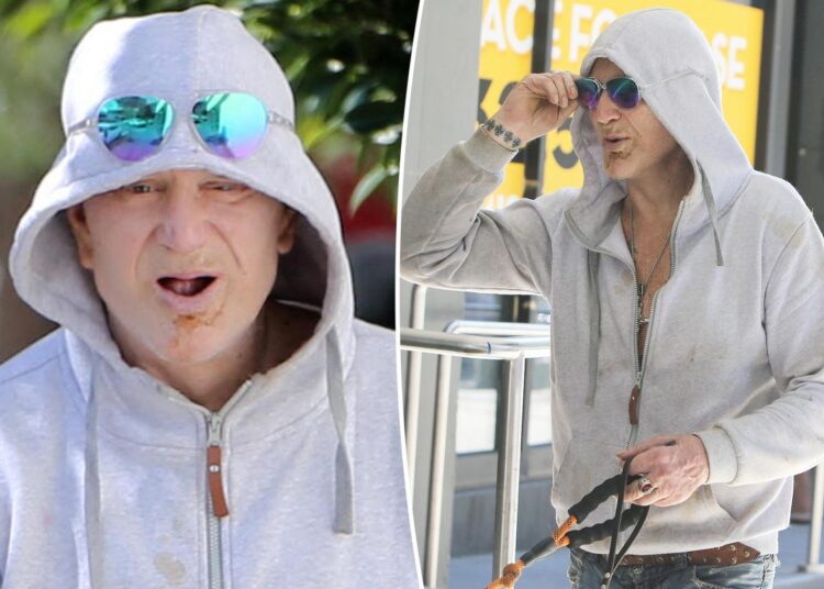 Mickey Rourke shows off missing teeth after being evicted from LA home
