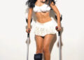 Woman in white outfit using crutches with a medical boot on her left leg.