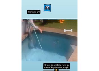 Ruby Rose Hospitalized After Falling Into Pool