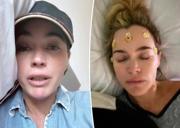 Teddi Mellencamp gives rare update on what 'cancer recovery looks like' in tearful video