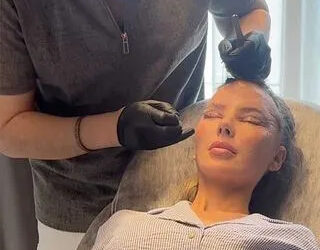 Millie Thompson getting her stitched taken out after undergoing plastic surgeryCredit: Millie Thompson/Instagram