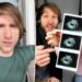 YouTuber Jesse Ridgway unbothered by 'hypocritical' backlash over pregnancy termination