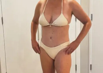 Amy Schumer’s Skimpy White Bikini Photos Highlight More Than Her 50-Lb Weight Loss
