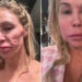 Brandi Glanville showing off her facial disfigurementCredit: BrandiGlanville/X; Brandi Glanville/Instagram