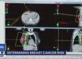 Jillian Cardarelli shares update amid breast cancer battle