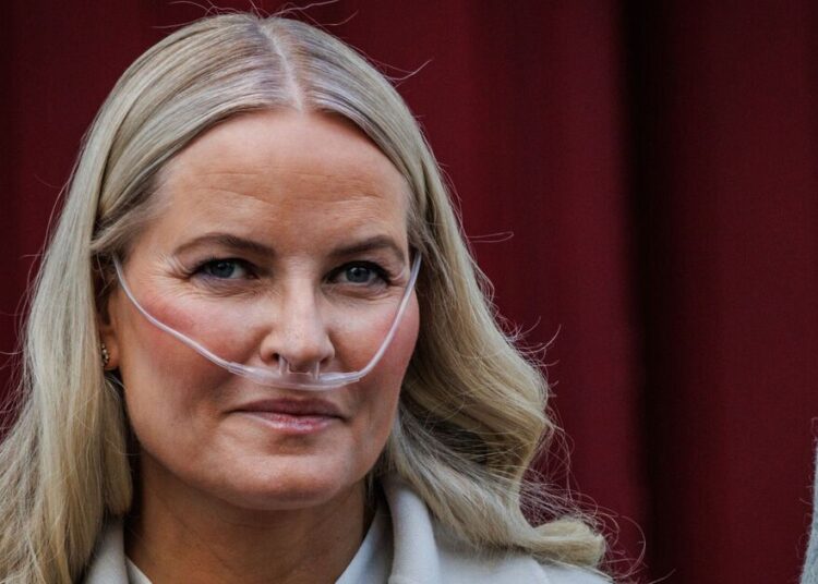 Palace issues statement after royal undergoes major surgery | Royal | News