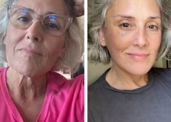 Ricki Lane shares before-and-after photos of her facelift after two yearsCredit: Instagram/Ricki Lane