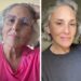 Ricki Lane shares before-and-after photos of her facelift after two yearsCredit: Instagram/Ricki Lane
