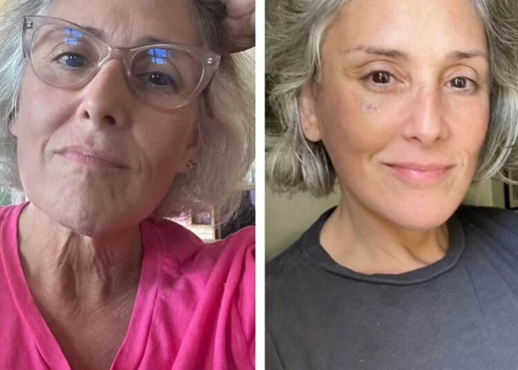 Ricki Lake before and after her faceliftCredit: Ricki Lake/Instagram