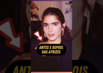 Antes e depois das Atrizes #fofocas #fofoca #famosos #noticias #famosa #atriz #novela #fama #famoso