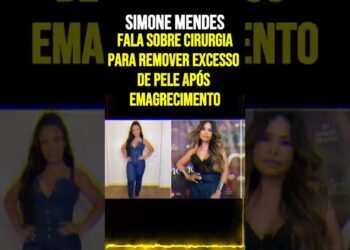 Simone Mendes Fala Sobre Cirurgia para Remover Excesso de Pele Após Emagrecimento