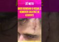 Zé Neto Quer Renovar o Visual e Remover Cicatriz de Acidente