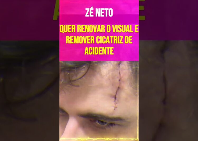 Zé Neto Quer Renovar o Visual e Remover Cicatriz de Acidente
