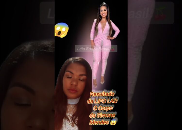 Resultado da LIPO LAD Simone Mendes está um show 😱 #fofoca #famosos #fama  #simonemendes #kakadiniz