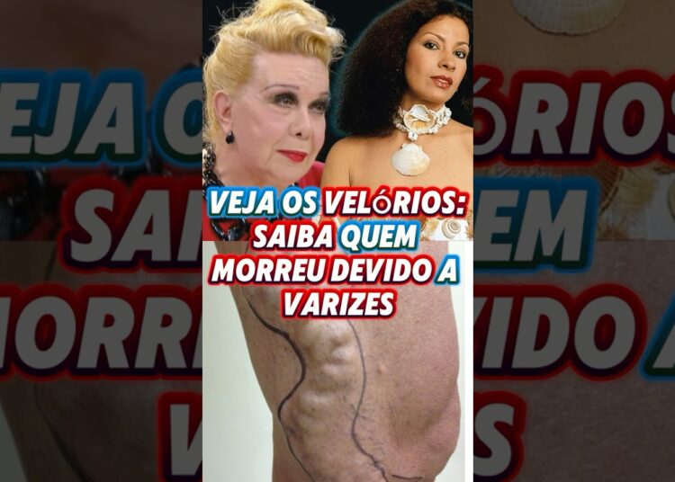 VELÓRIOS: Ela MORREU Devido a VARIZES #shorts #celebridades #novela