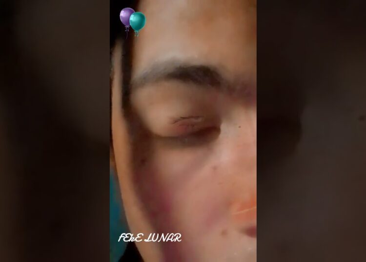BIOKKINESS FEKE  REALEZA