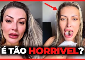 35 FAMOSOS QUE ARRUINARAM A CARREIRA COM CIRURGIAS PLÁSTICAS IRRECONHECÍVEIS… 😱