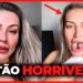 35 FAMOSOS QUE ARRUINARAM A CARREIRA COM CIRURGIAS PLÁSTICAS IRRECONHECÍVEIS… 😱
