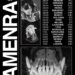 Amenra Compartilhe o segundo novo single "Forlorn" junto com o videoclipe