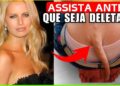 15 Celebridades… Com Estranhas DEFORMIDADES Corporais Que Vão Deixar Você Chocado! Documentário