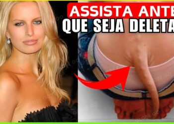 15 Celebridades… Com Estranhas DEFORMIDADES Corporais Que Vão Deixar Você Chocado! Documentário