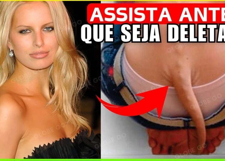 15 Celebridades… Com Estranhas DEFORMIDADES Corporais Que Vão Deixar Você Chocado! Documentário