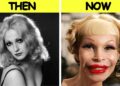 65 Disastrous Plastic Surgeries of Celebrities  Before and After THEN NOW